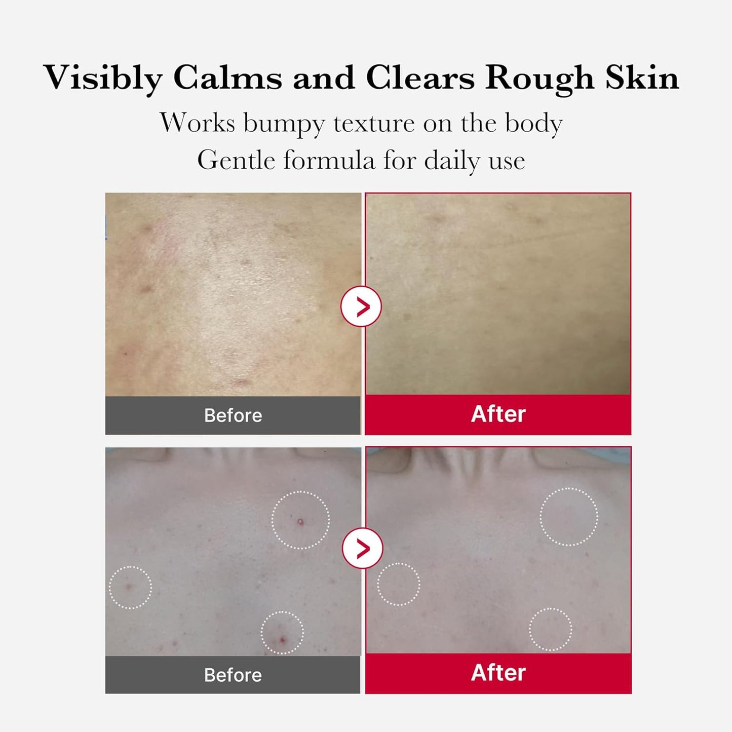 Red Body Peeling Shot Cleanser