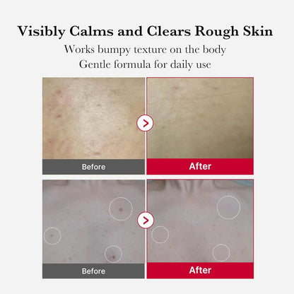 Red Body Peeling Shot Cleanser