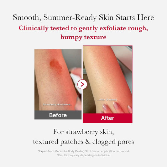 Red Body Peeling Shot Cleanser